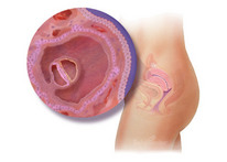 4-nedelya-beremennost